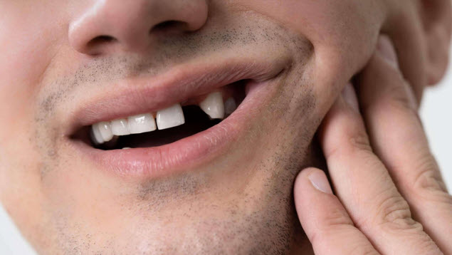 nằm mơ bị rụng răng