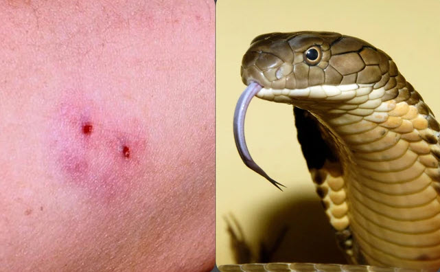 nằm mơ thấy bị rắn cắn